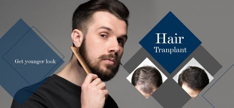 How Successful Is A Hair Transplant?